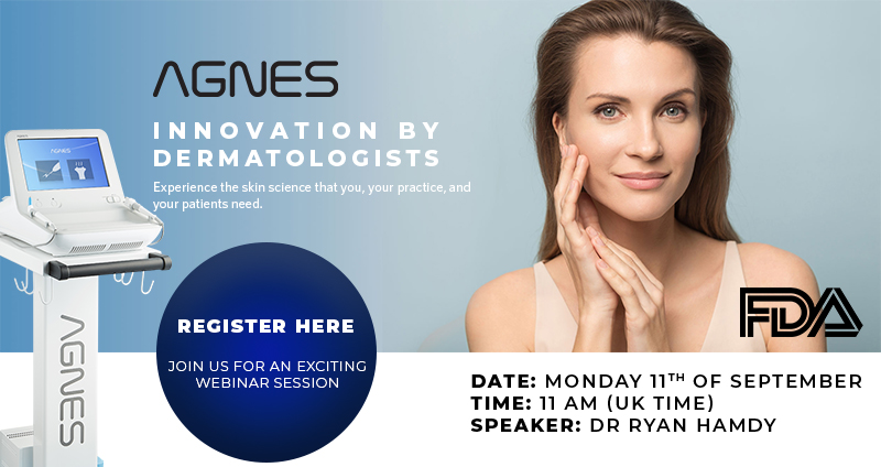 Agnes RF Webinar banner