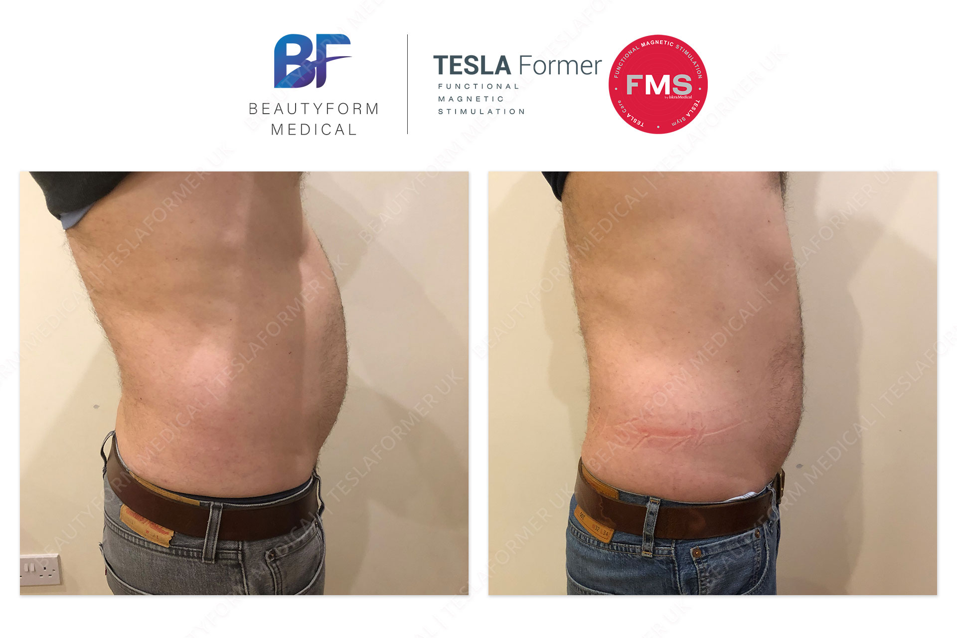 Tesla Former Abs before and after Build Muscle Burn Fat