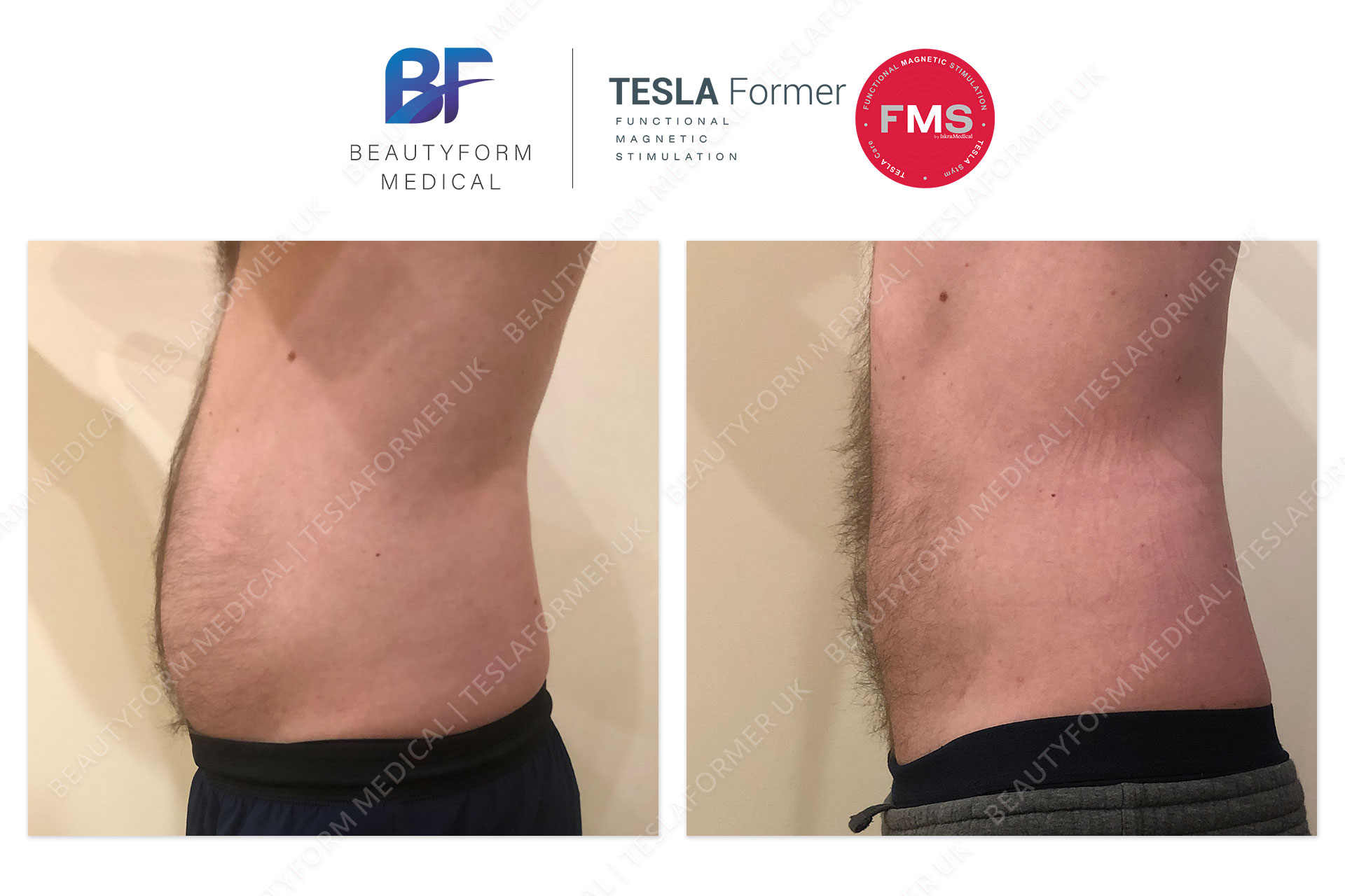 Tesla Former Abs before and after Build Muscle Burn Fat